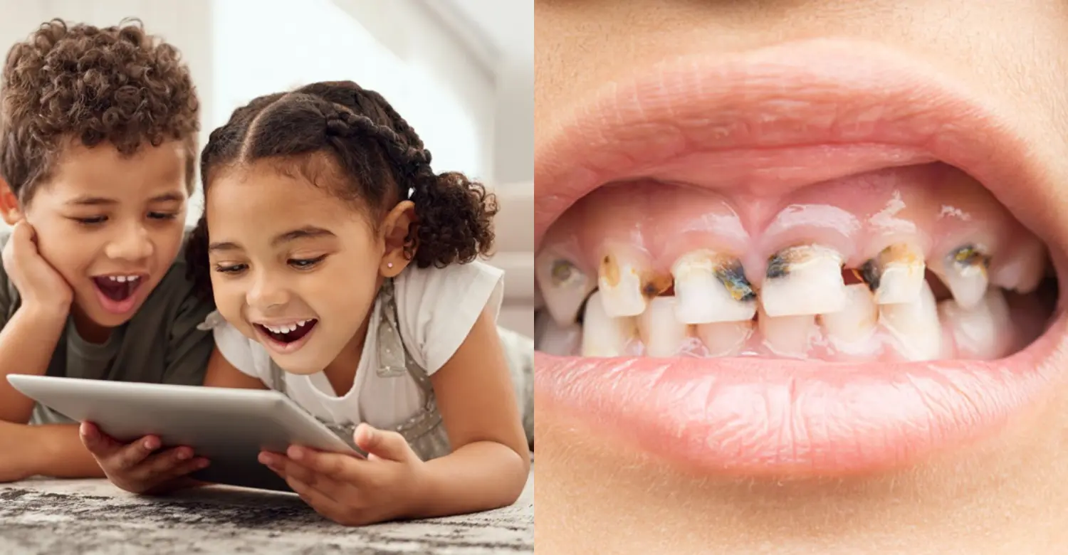 Screen Time and Tooth Decay 2